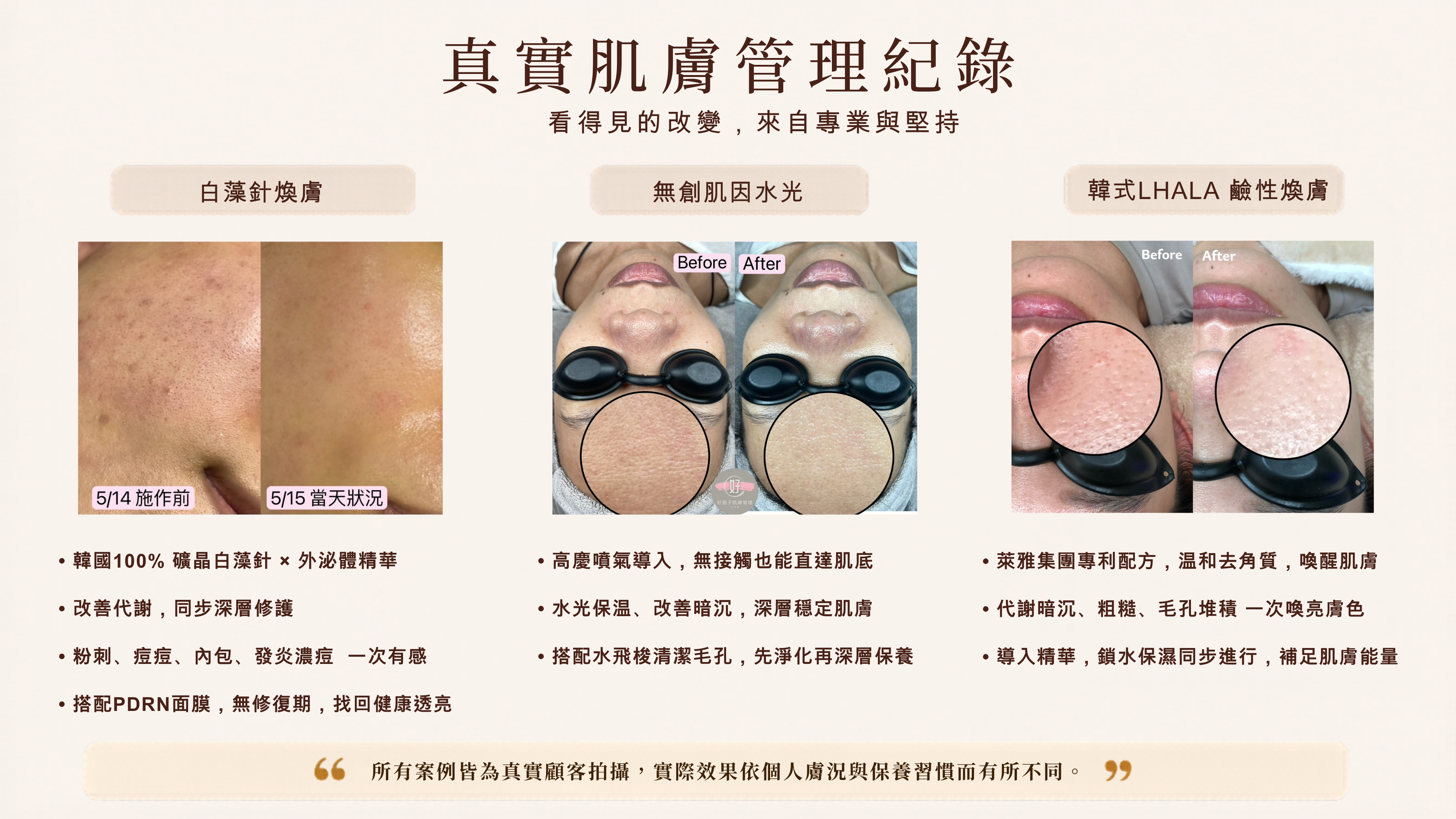 真實肌膚管理前後紀錄